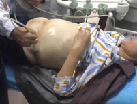 凉山州第一人民医院顺利完成州内首例肿瘤患者  彩超引导体腔热灌注治疗